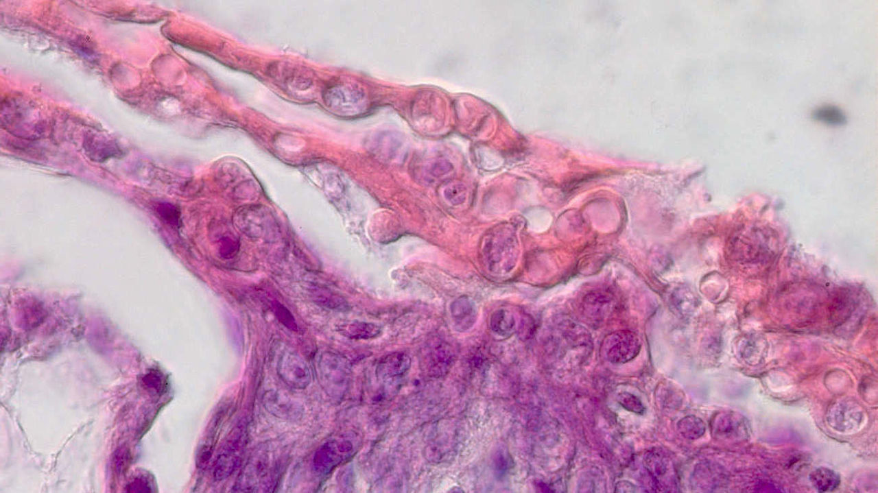 Der tödliche Pilz im histologischen Präparat von Froschhaut | Frank Mutschmann