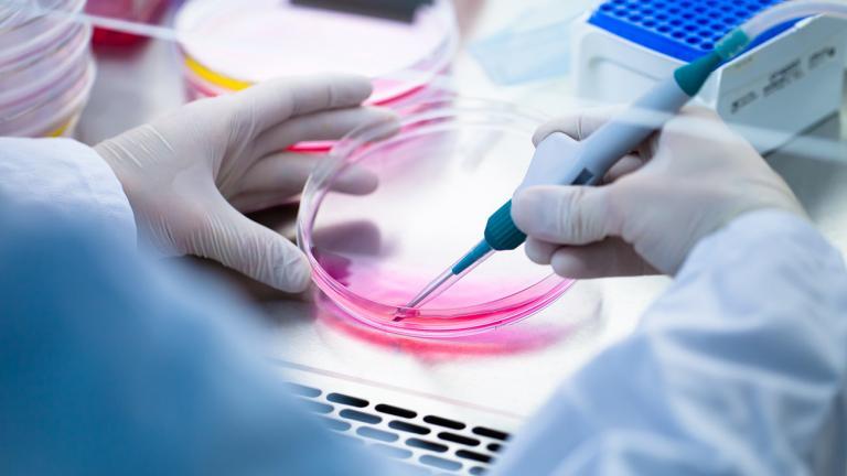 The Axolotl is especially interesting to medical scientists because it keeps its larval tissue its entire life. | PolakPhoto, Shutterstock